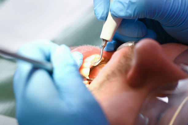 Best Pediatric Emergency Dentist in Burke, VA