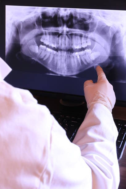 Best Emergency Dental Care for Broken or Chipped Teeth in Burke, VA
