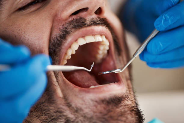 Best Emergency TMJ Treatment in Burke, VA
