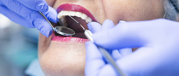 Best Urgent Care for Lost Fillings or Crowns in Burke, VA